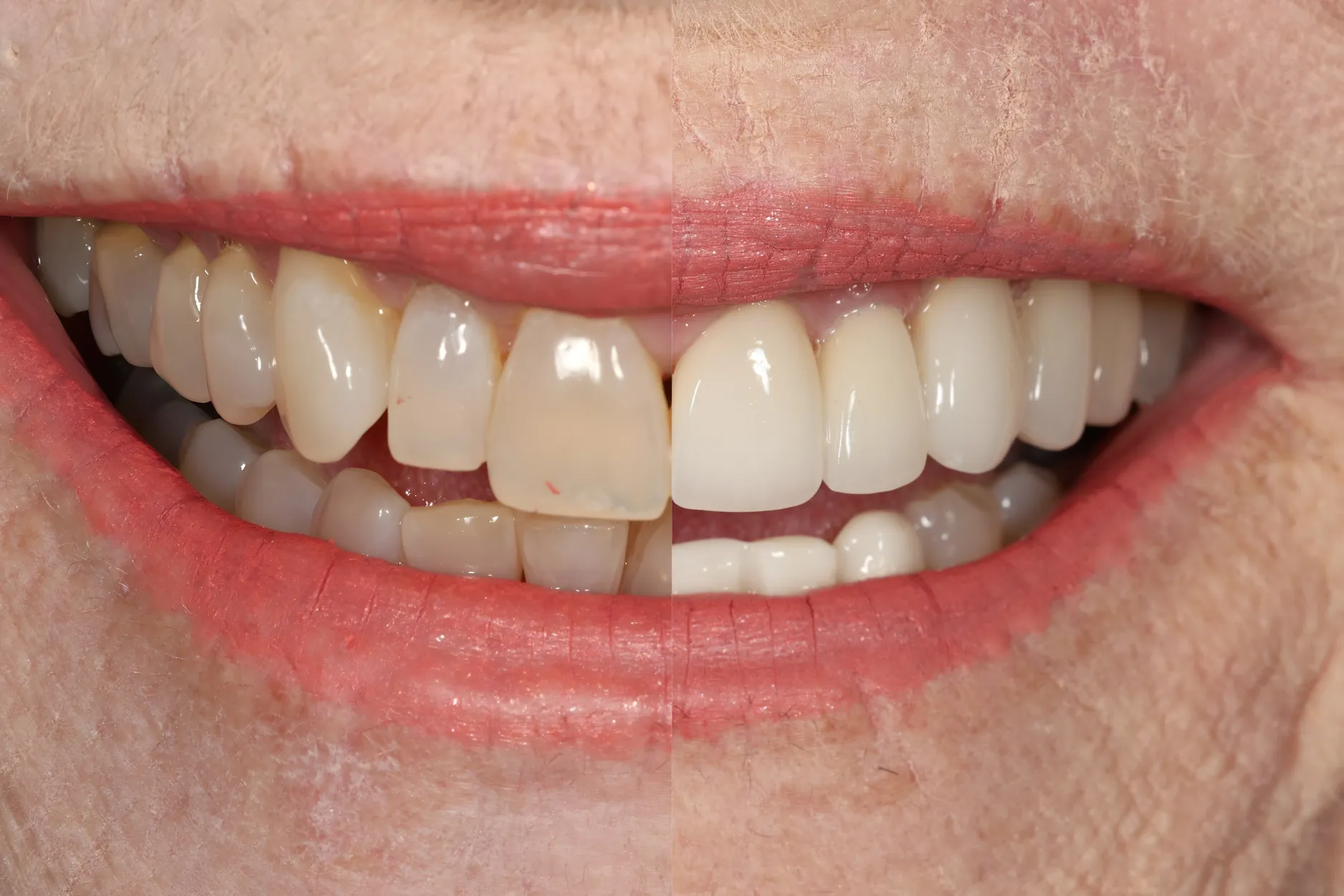 Esthetic and Rehabilitative Dentistry